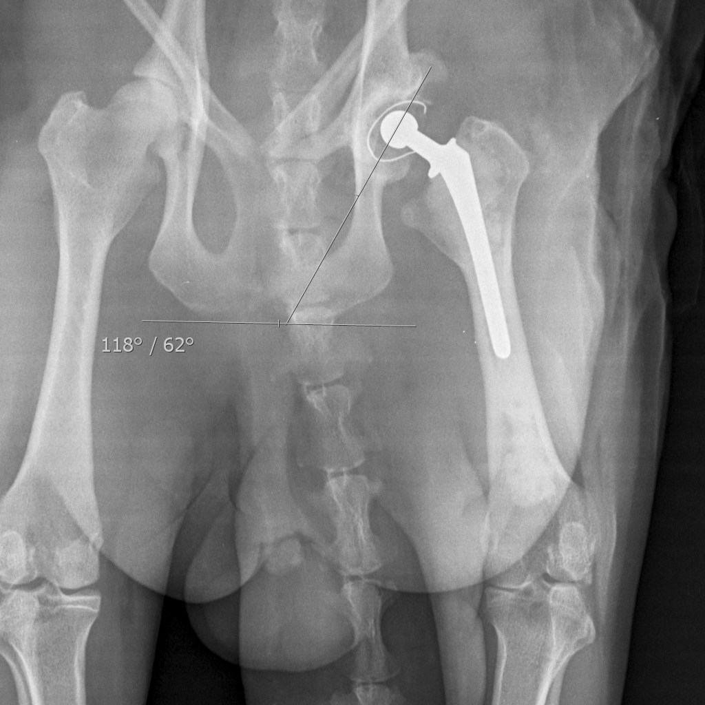 1_Talei_orana_post_surgery_x-ray_showing_full_hip_replacement_on_right_side.jpeg